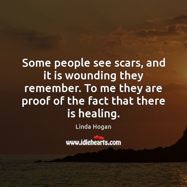 Some people see scars, and it is wounding they remember. To me Image